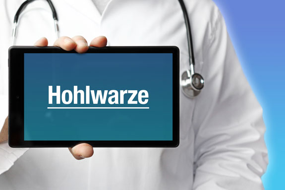 Eingezogene Brustwarzen Heilbronn